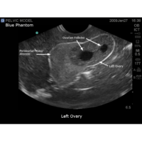 BPOB1220_1