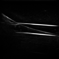 PICC II_1