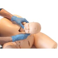 80103-04-c-section_disimpactedhead