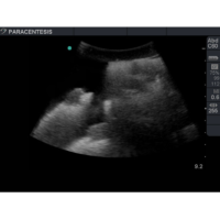 BPPara1301_3