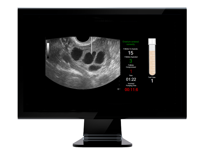 black-lcd-display