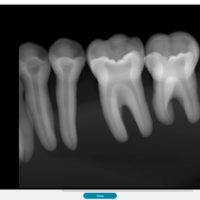 x-ray-new