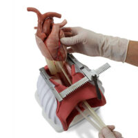 Surgical sam 3