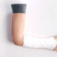 70250-colles-fracture-05