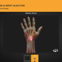 screenshot_20201027-161247_hand-wrist-injection