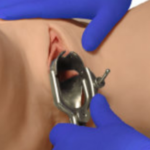 ModelMed_speculum