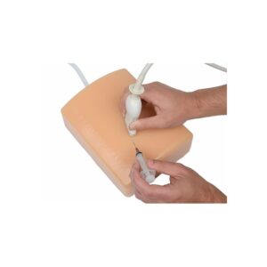 Abscess_1