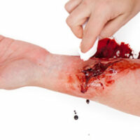 Lacerations-simwounds-595x375