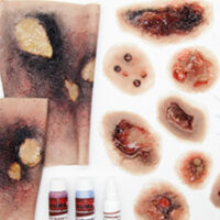 SIMBODIES-Burns-Kit-1-595x375