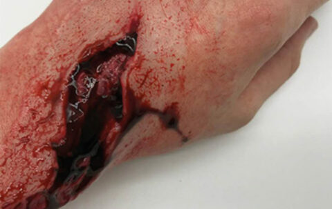 SIMBODIES-Lacerations-Kit-3-595x375