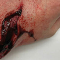 SIMBODIES-Lacerations-Kit-3-595x375