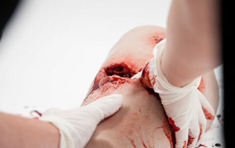 SIMBODIES-Thigh-Wound-Packing-Trainer-1-595x375