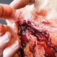 SIMBODIES-Various-Wounds-Kit-2-595x375